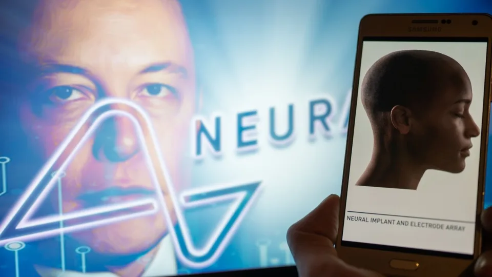 Technologijų lenktynės įsibėgėja: po „Neuralink“ nesėkmių – Kinijos kontrsmūgis