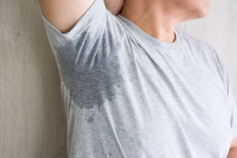 Pageltę prakaito dėmės ant baltų marškinėlių? Paprastas būdas atgaivinti net seniausius drabužius